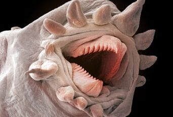 ¿Qué gusanos pueden vivir en el cuerpo humano