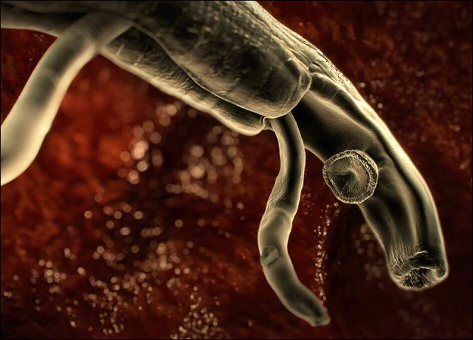 Parásitos en el cuerpo humano.
