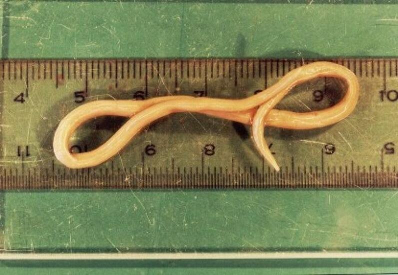 Parásito lombriz intestinal del cuerpo humano.