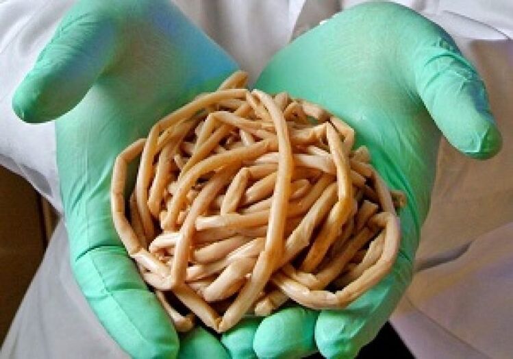 Gusanos parásitos del cuerpo humano.