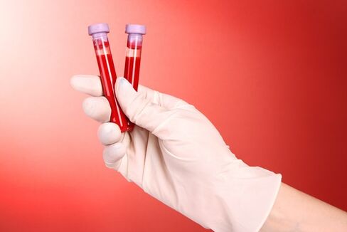 Análisis de sangre para parásitos.